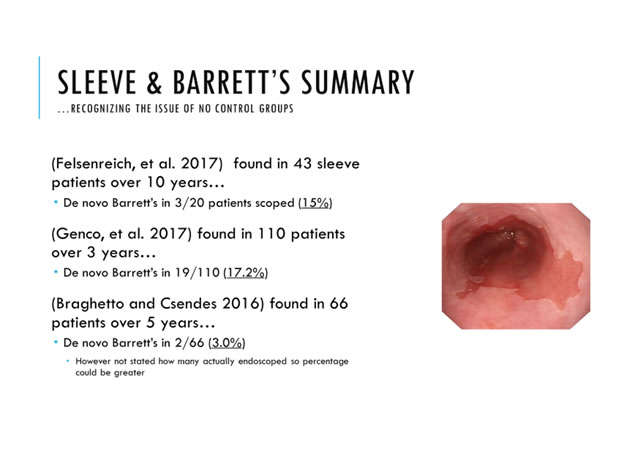 Sleve & Barrett's Summary