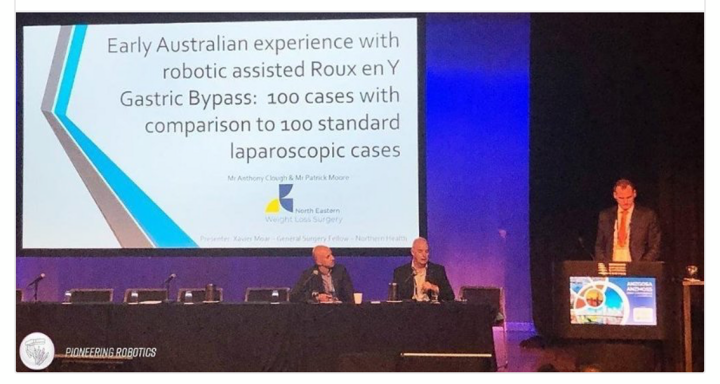 These results were presented at the recent ANZMOSS/ANZGOSA conference in Brisbane (Oct 2-4 2019) by Fellow in Surgery Mr Xavier Moare. 