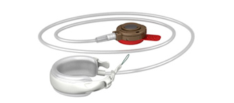 Swedish Adjustable Gastric Band (Obtech/Ethicon Endosurgery)